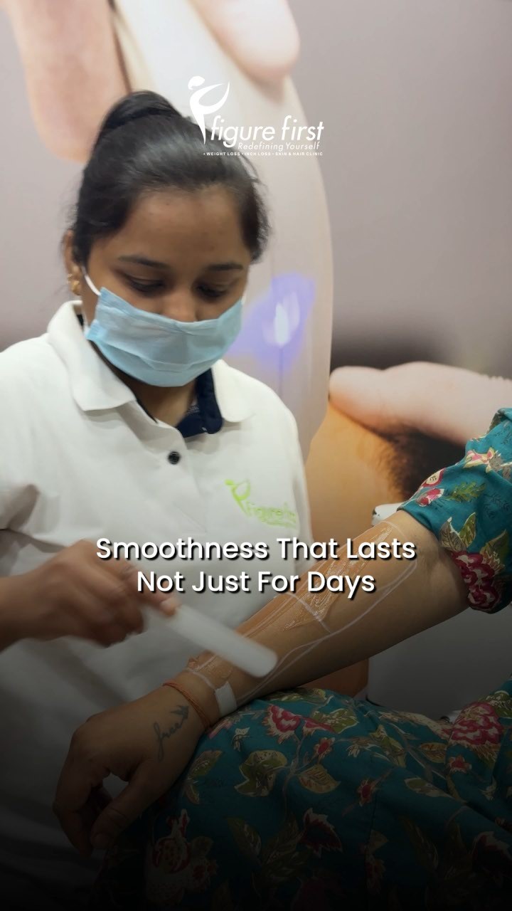 Smoothness That Lasts — Full Arm Laser Session